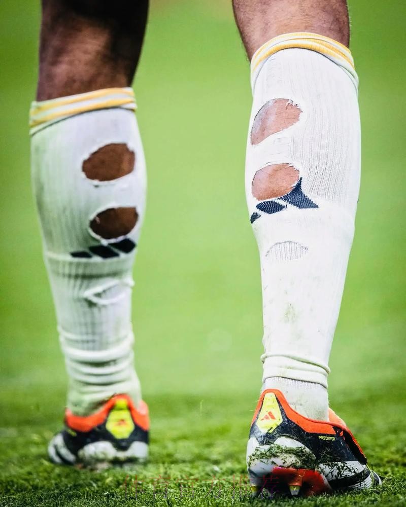 贝林穿破洞球袜属于违规 但因健康因素放宽限制 贝林穿破洞球袜属于违规 但因健康因素放宽限制